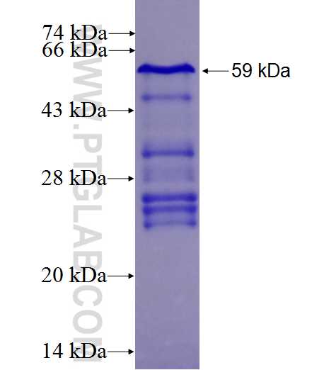 DLK1 fusion protein Ag0991 SDS-PAGE