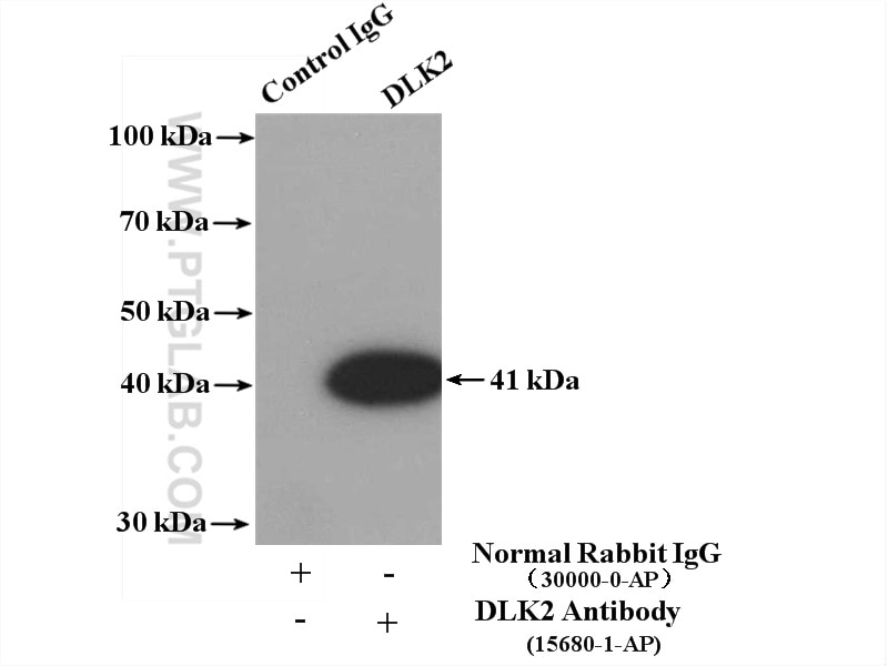 Immunoprecipitation (IP) experiment of mouse brain tissue using DLK2 Polyclonal antibody (15680-1-AP)