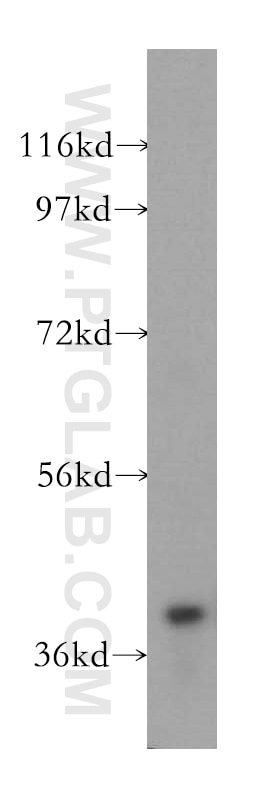 WB analysis of mouse brain using 15680-1-AP