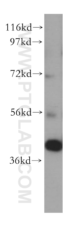Western Blot (WB) analysis of human liver tissue using DLK2 Polyclonal antibody (15680-1-AP)