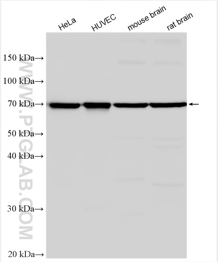 Western Blot (WB) analysis of various lysates using DLL1 Polyclonal antibody (28544-1-AP)