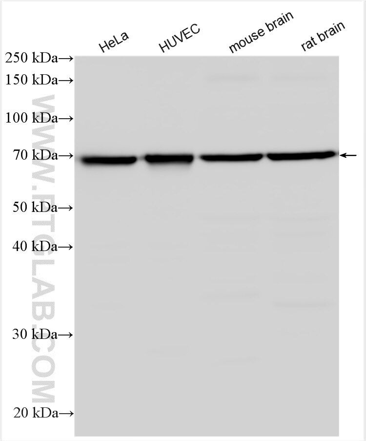 Western Blot (WB) analysis of various lysates using DLL1 Polyclonal antibody (28544-1-AP)