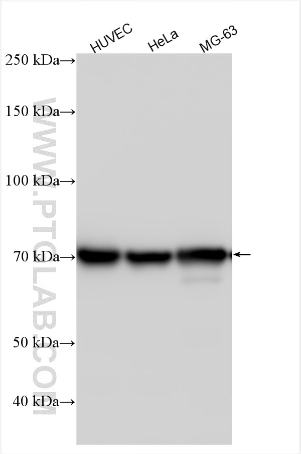 Western Blot (WB) analysis of various lysates using DLL1 Polyclonal antibody (28544-1-AP)