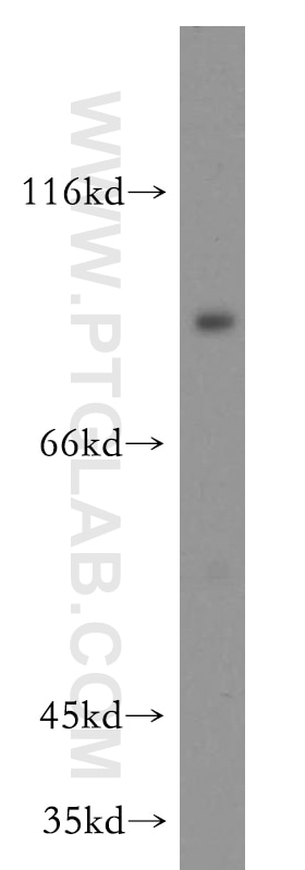 Western Blot (WB) analysis of human placenta tissue using DLL1-Specific Polyclonal antibody (20230-1-AP)