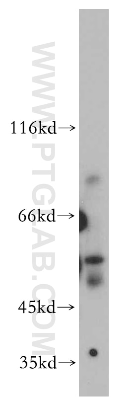 Western Blot (WB) analysis of mouse lung tissue using DLL1-Specific Polyclonal antibody (20230-1-AP)