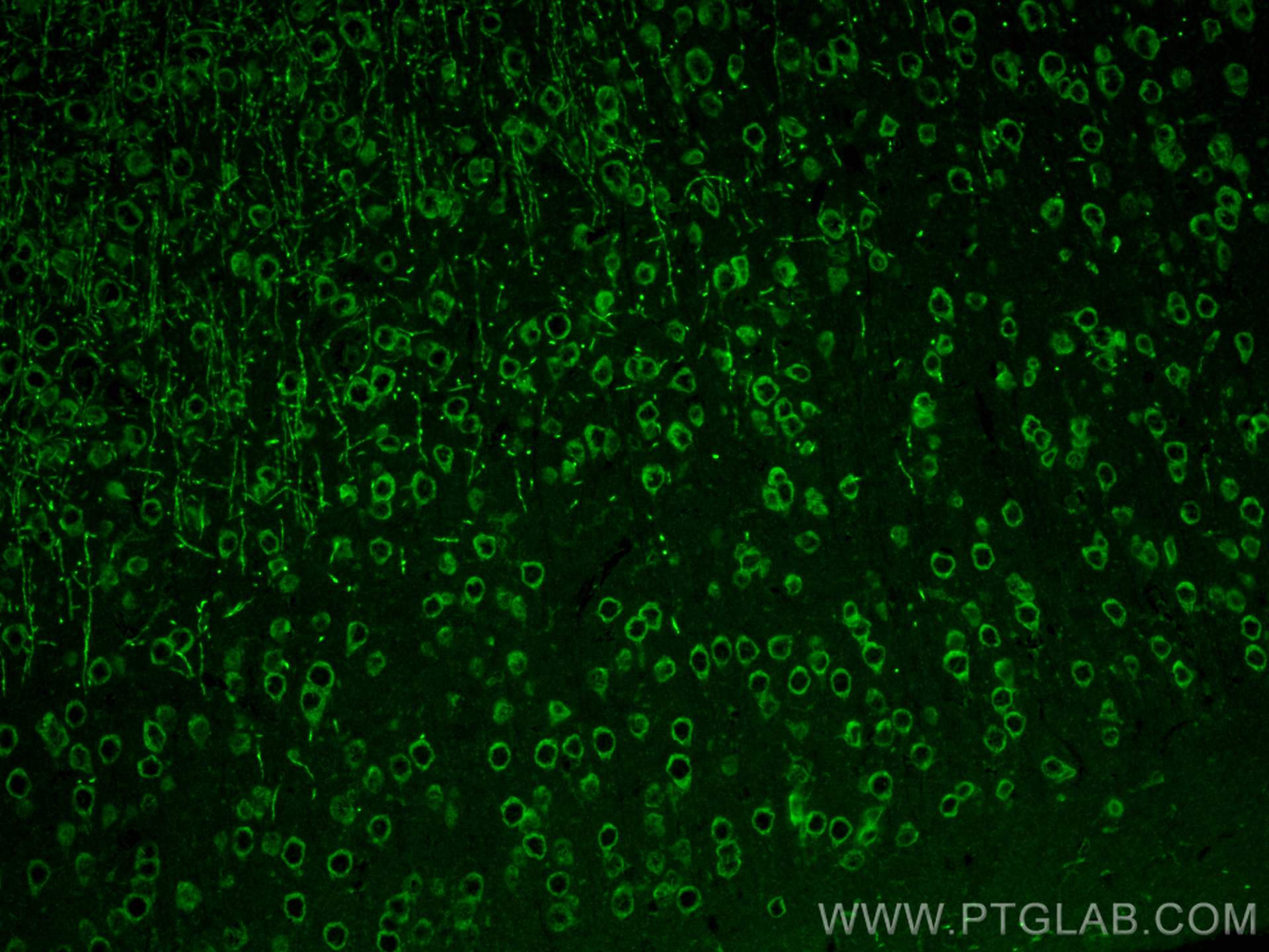 Immunofluorescence (IF) / fluorescent staining of mouse brain tissue using DLL3 Polyclonal antibody (25535-1-AP)