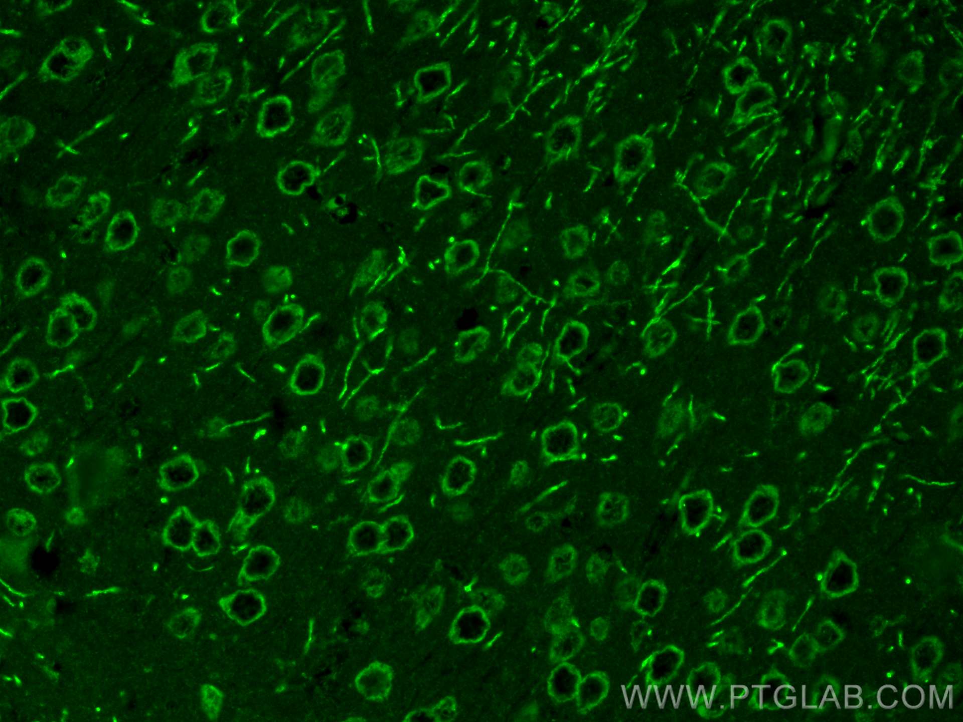 Immunofluorescence (IF) / fluorescent staining of mouse brain tissue using DLL3 Polyclonal antibody (25535-1-AP)