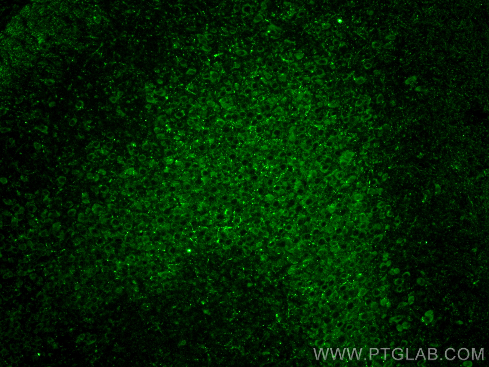 Immunofluorescence (IF) / fluorescent staining of mouse brain tissue using DLL3 Polyclonal antibody (25535-1-AP)