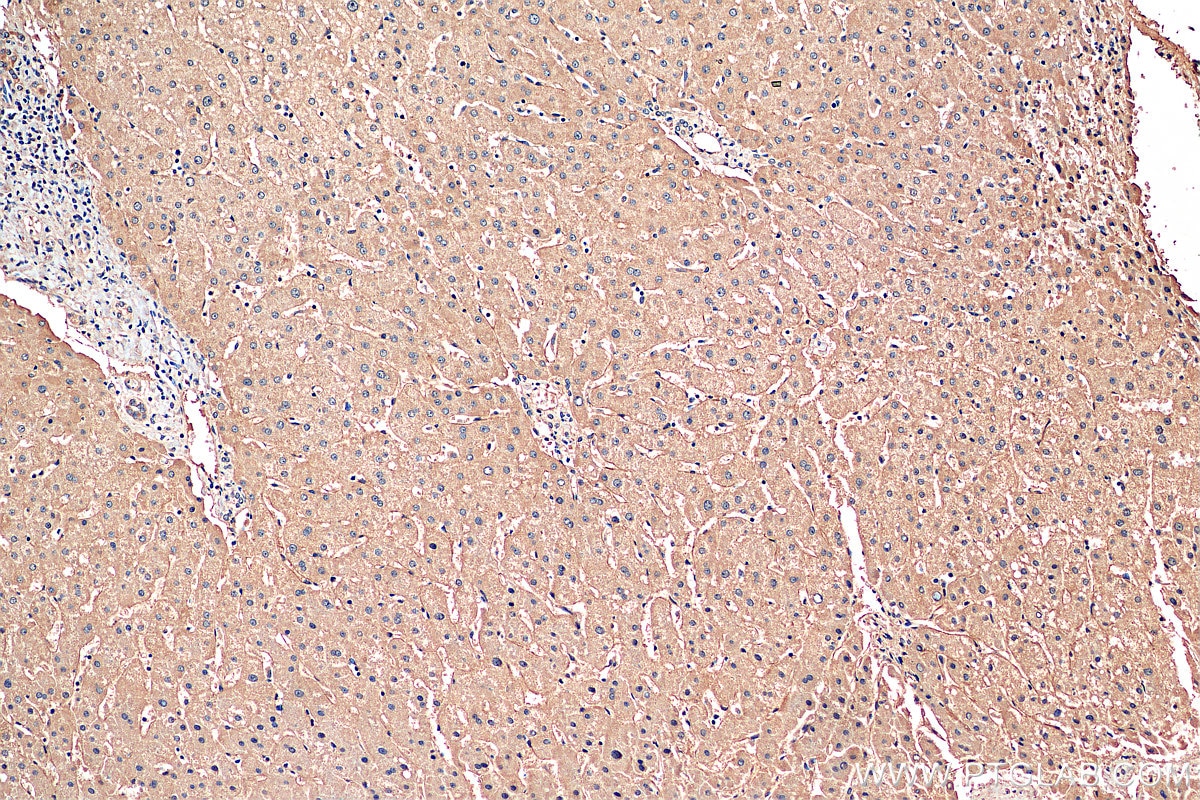 Immunohistochemistry (IHC) staining of human liver tissue using DLL3 Polyclonal antibody (25535-1-AP)