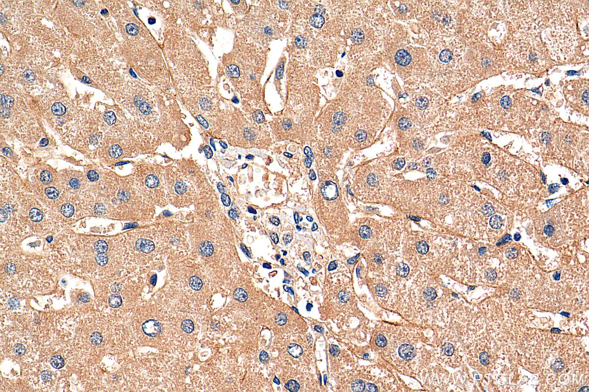 IHC staining of human liver using 25535-1-AP