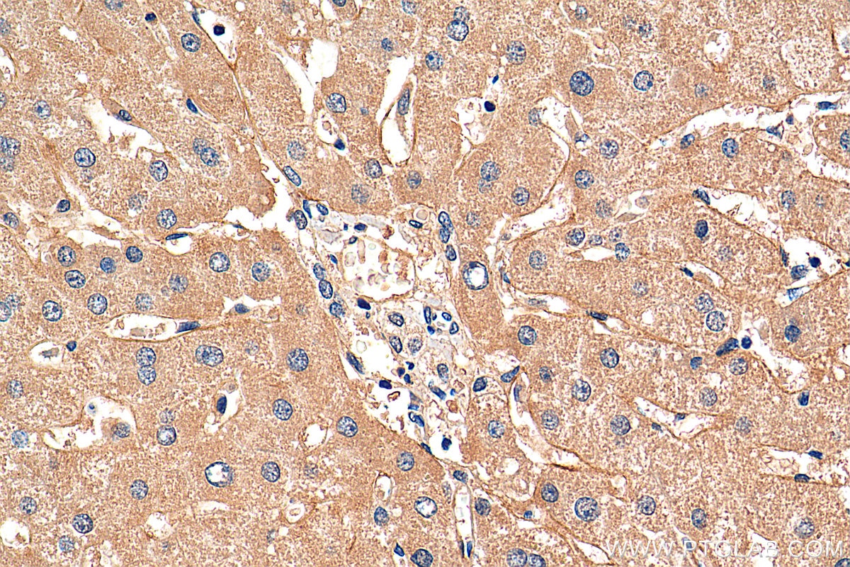 Immunohistochemistry (IHC) staining of human liver tissue using DLL3 Polyclonal antibody (25535-1-AP)