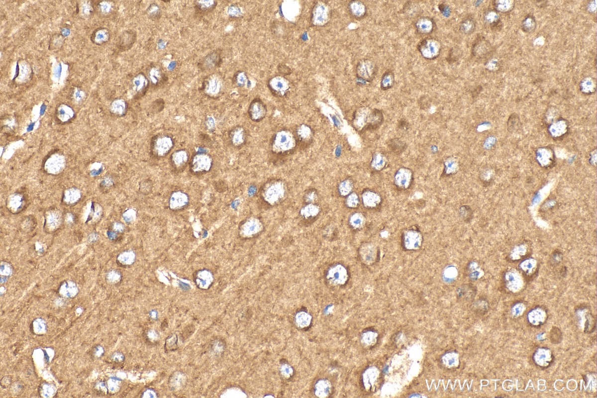 Immunohistochemistry (IHC) staining of mouse brain tissue using DLL3 Polyclonal antibody (25535-1-AP)