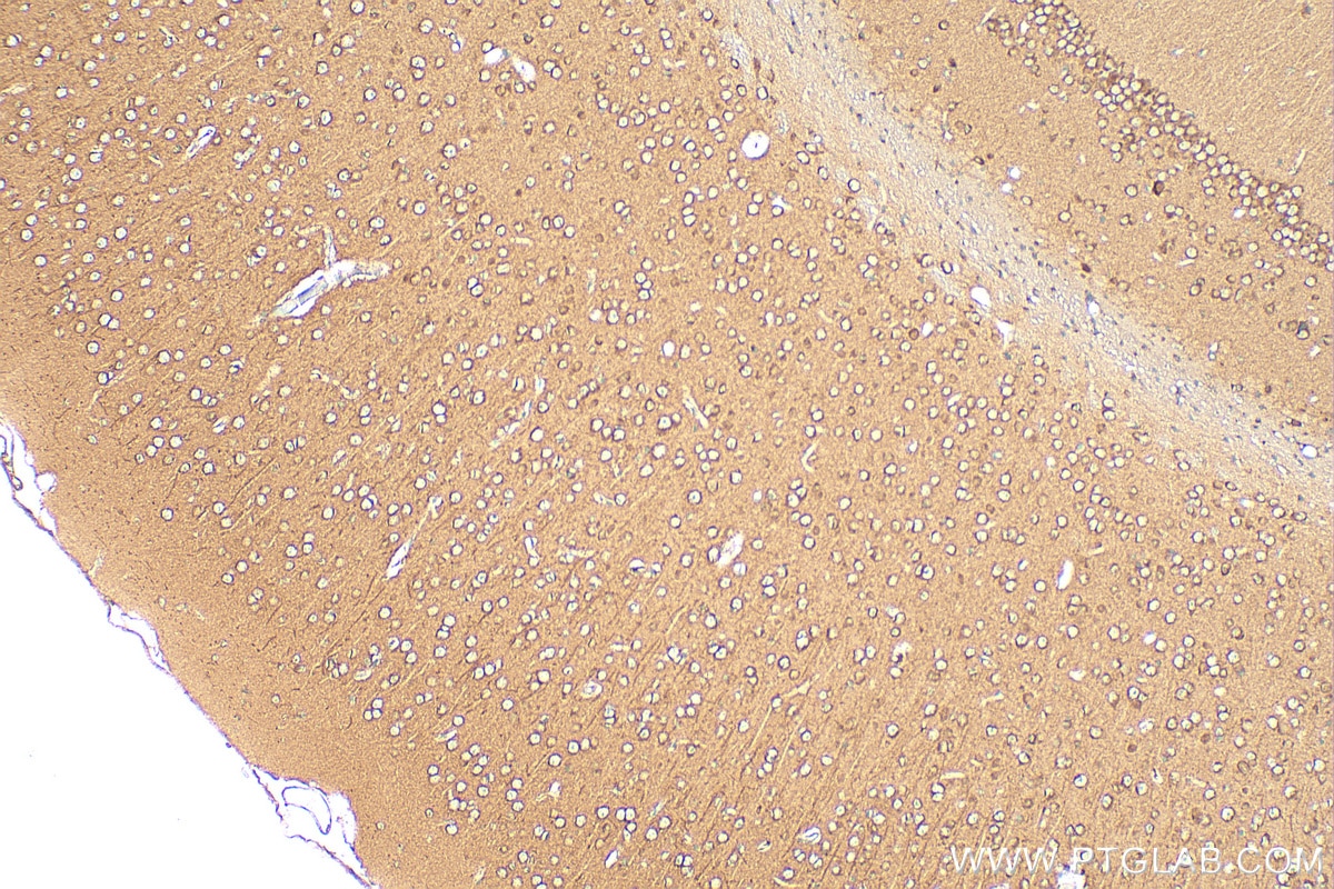 Immunohistochemistry (IHC) staining of mouse brain tissue using DLL3 Polyclonal antibody (25535-1-AP)