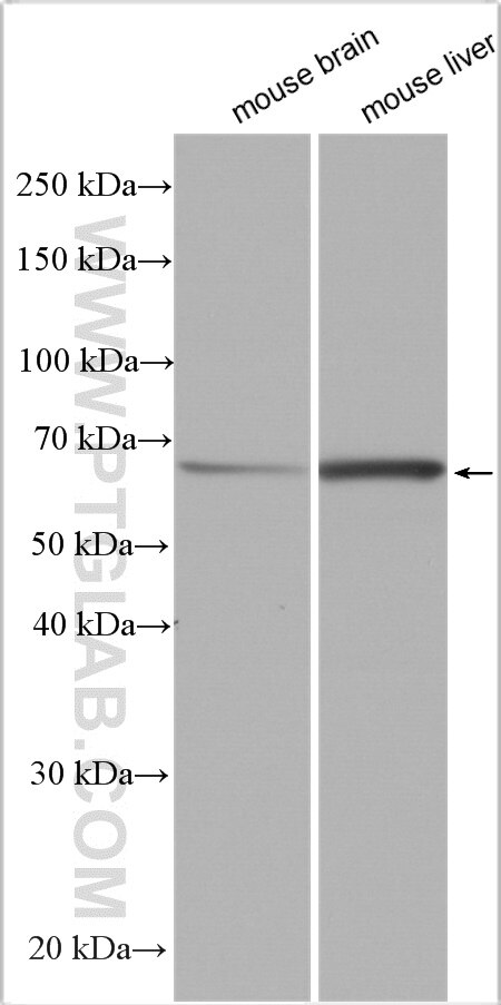 Western Blot (WB) analysis of various lysates using DLL3 Polyclonal antibody (25535-1-AP)