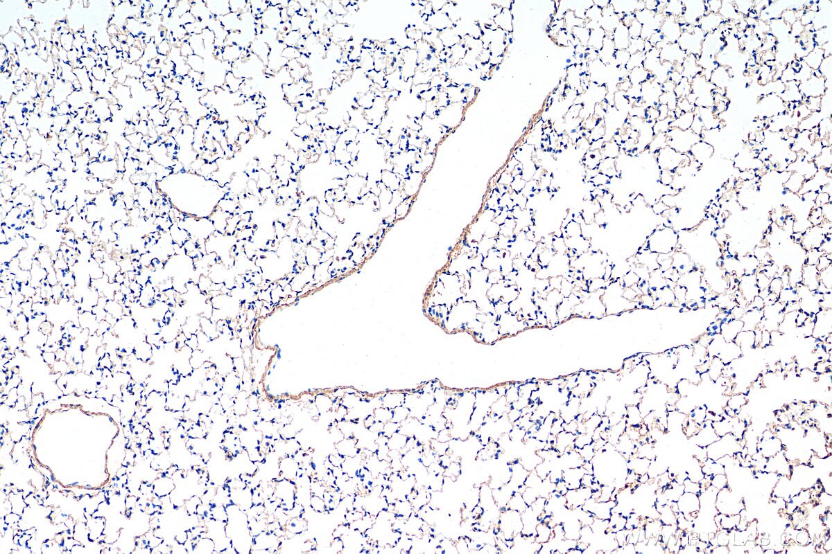 Immunohistochemistry (IHC) staining of mouse lung tissue using DLL4 Polyclonal antibody (21584-1-AP)
