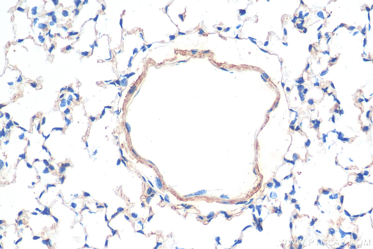 Immunohistochemistry (IHC) staining of mouse lung tissue using DLL4 Polyclonal antibody (21584-1-AP)