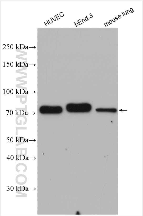 Western Blot (WB) analysis of various lysates using DLL4 Polyclonal antibody (21584-1-AP)