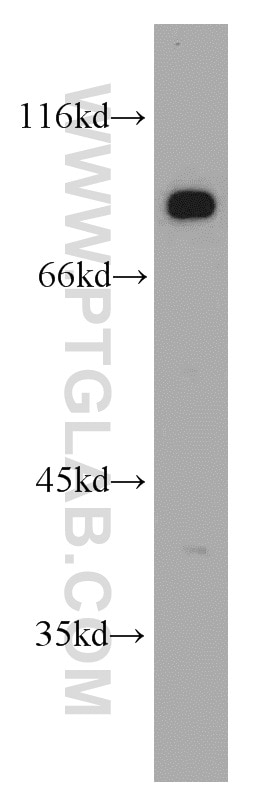 Western Blot (WB) analysis of mouse brain tissue using DLL4 Polyclonal antibody (21584-1-AP)