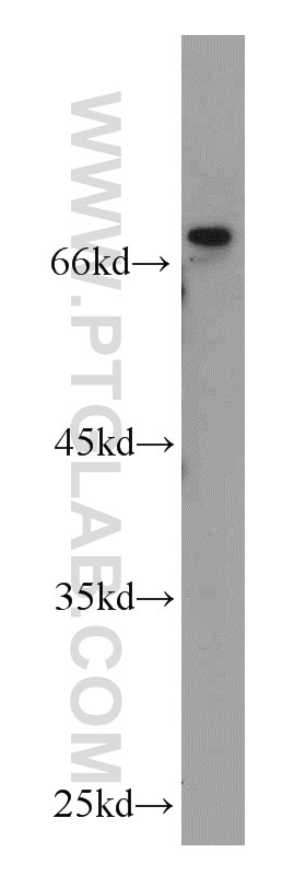 Western Blot (WB) analysis of A431 cells using DLL4 Polyclonal antibody (21584-1-AP)