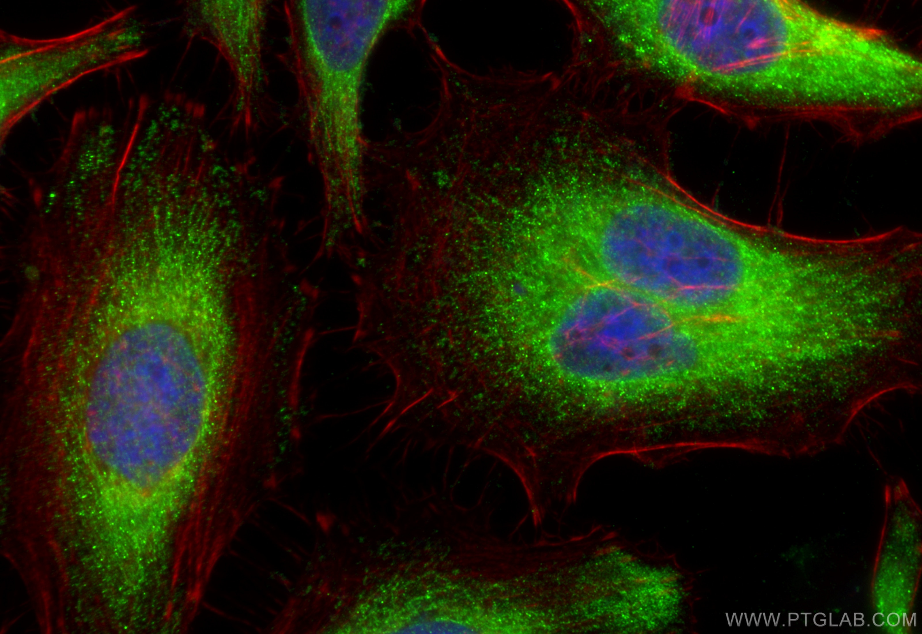 Immunofluorescence (IF) / fluorescent staining of HeLa cells using DLST Polyclonal antibody (31174-1-AP)