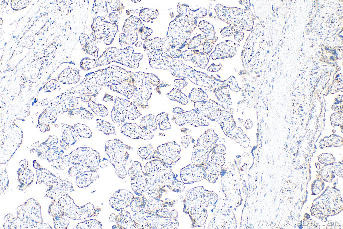 Immunohistochemistry (IHC) staining of human placenta tissue using DLST Polyclonal antibody (31174-1-AP)
