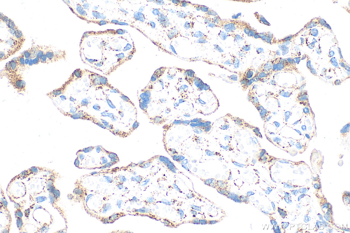 Immunohistochemistry (IHC) staining of human placenta tissue using DLST Polyclonal antibody (31174-1-AP)