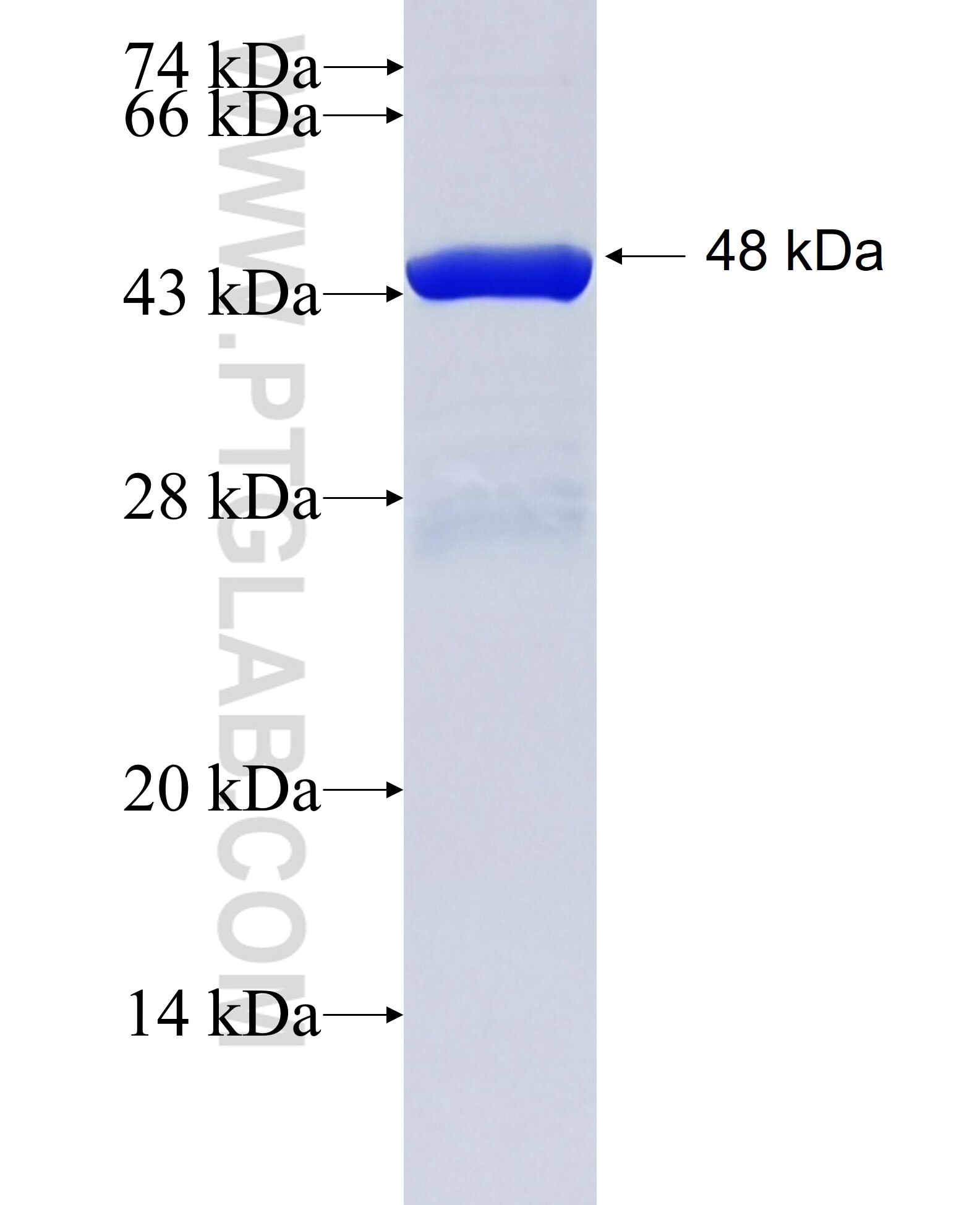 DLST fusion protein Ag34753 SDS-PAGE