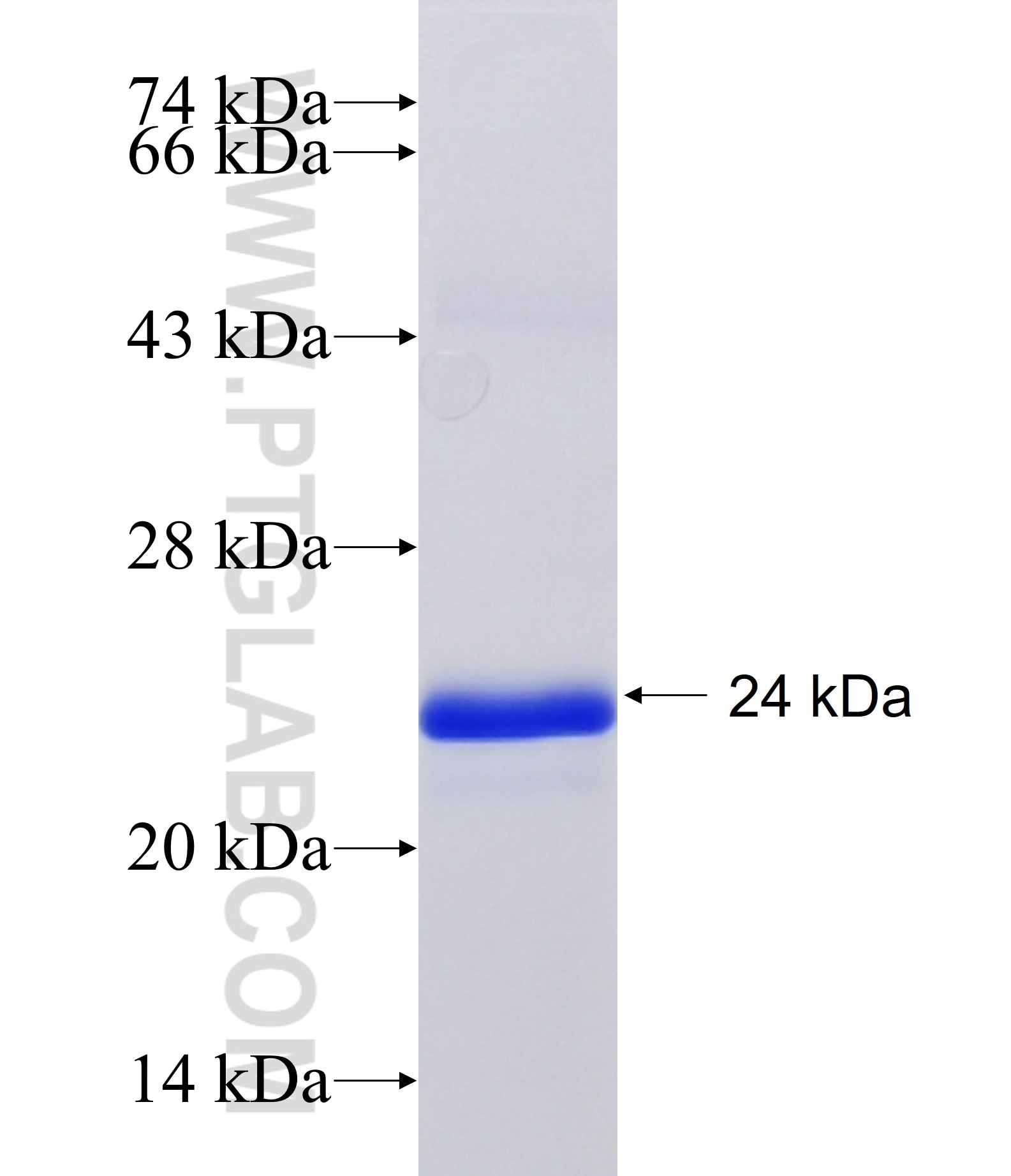 DLST fusion protein Ag35094 SDS-PAGE