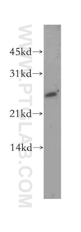 Western Blot (WB) analysis of A375 cells using DLX1 Polyclonal antibody (13046-1-AP)