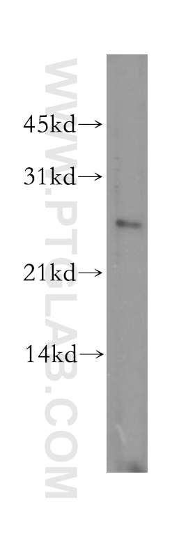 Western Blot (WB) analysis of human brain tissue using DLX1 Polyclonal antibody (13046-1-AP)