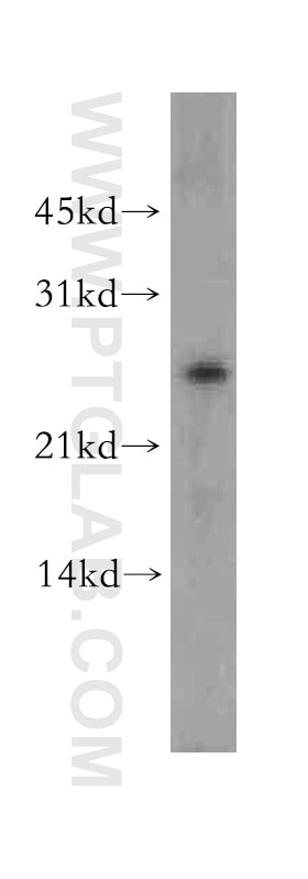 Western Blot (WB) analysis of HeLa cells using DLX1 Polyclonal antibody (13046-1-AP)