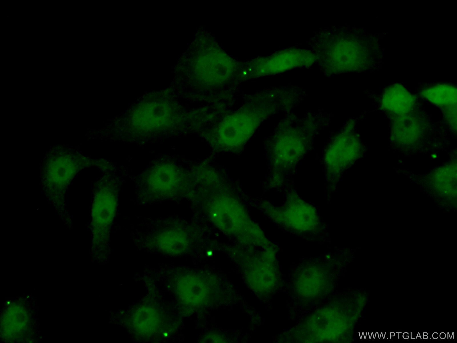 IF Staining of SH-SY5Y using 26244-1-AP