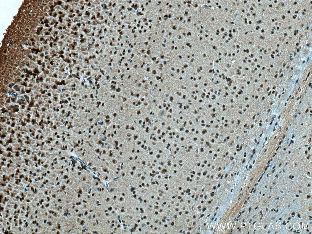 Immunohistochemistry (IHC) staining of mouse brain tissue using DLX2 Polyclonal antibody (26244-1-AP)