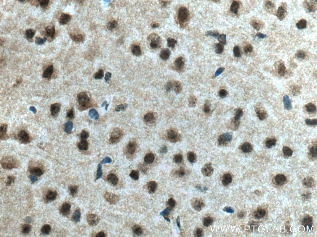 Immunohistochemistry (IHC) staining of mouse brain tissue using DLX2 Polyclonal antibody (26244-1-AP)