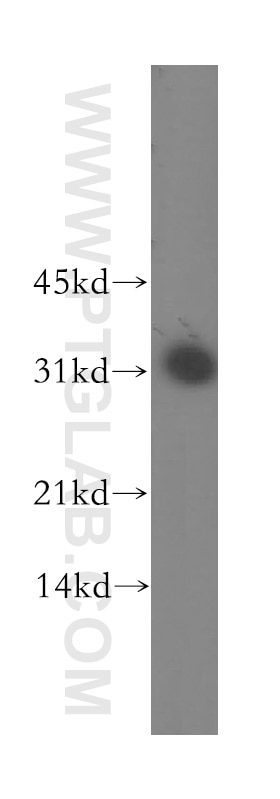 DLX3 Polyclonal antibody