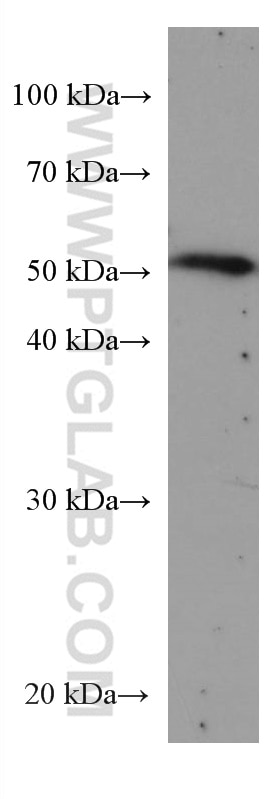 Western Blot (WB) analysis of HEK-293 cells using DLX3 Monoclonal antibody (67282-1-Ig)