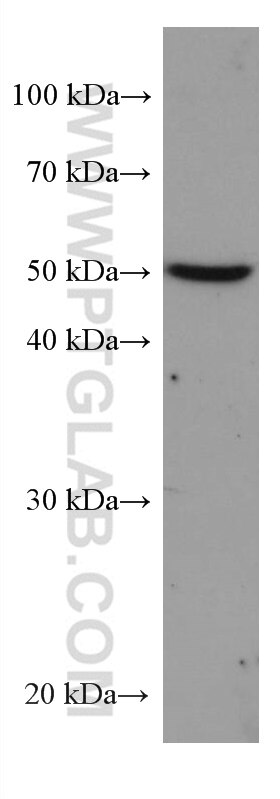 WB analysis of JAR using 67282-1-Ig