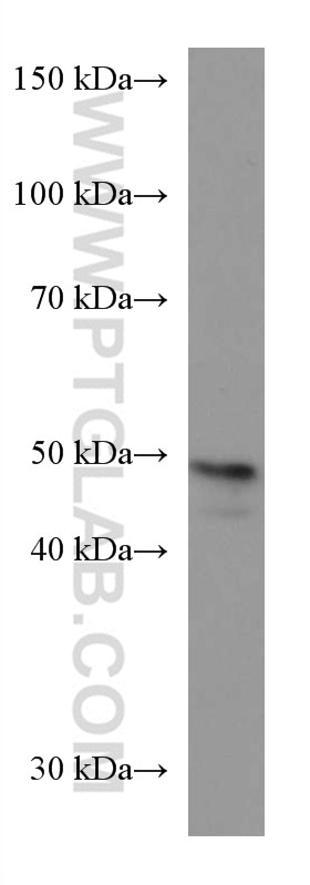 Western Blot (WB) analysis of NCCIT cells using DLX3 Monoclonal antibody (67282-1-Ig)