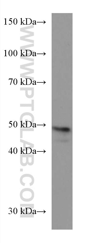 Western Blot (WB) analysis of NCCIT cells using DLX3 Monoclonal antibody (67282-1-Ig)