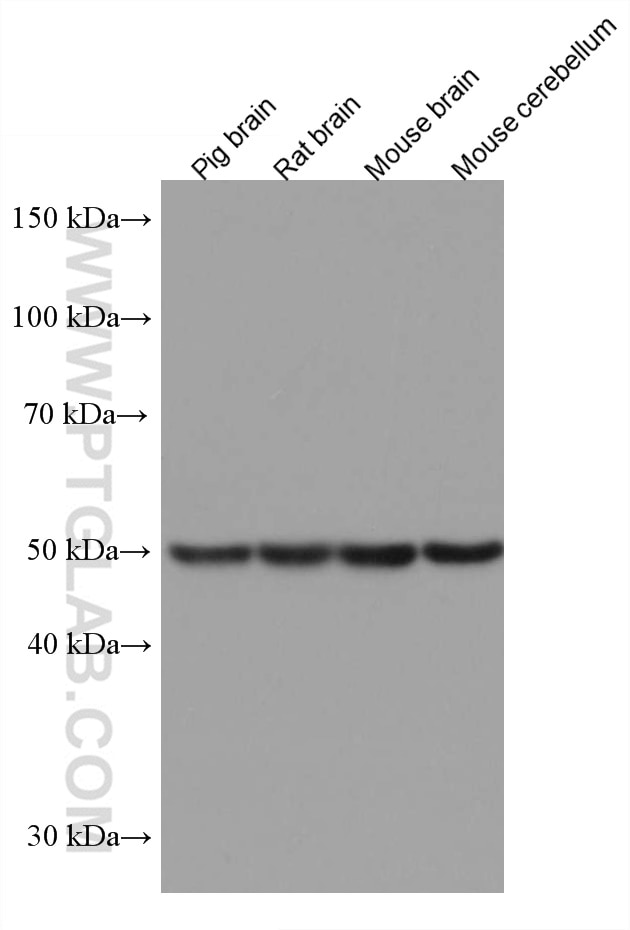 Western Blot (WB) analysis of various lysates using DLX3 Monoclonal antibody (67282-1-Ig)