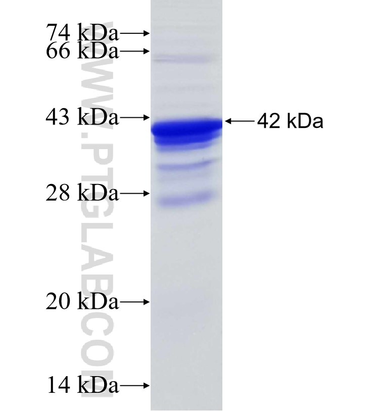 DLX3 fusion protein Ag29313 SDS-PAGE