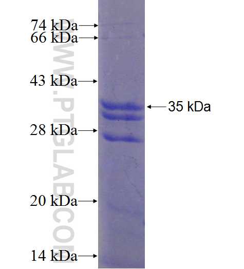 DLX4 fusion protein Ag2716 SDS-PAGE