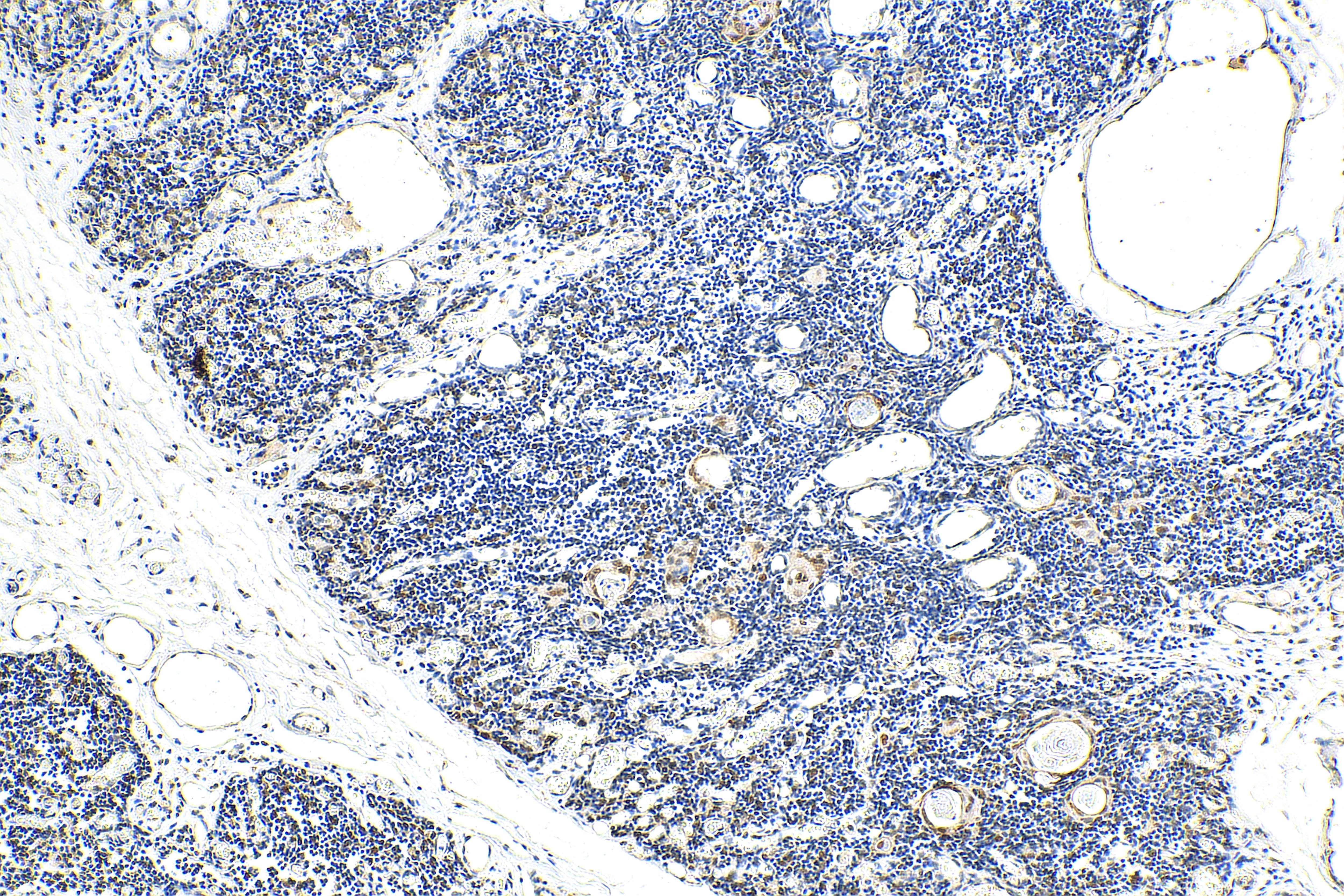 Immunohistochemistry (IHC) staining of human thymus tissue using DLX5 Polyclonal antibody (10592-1-AP)