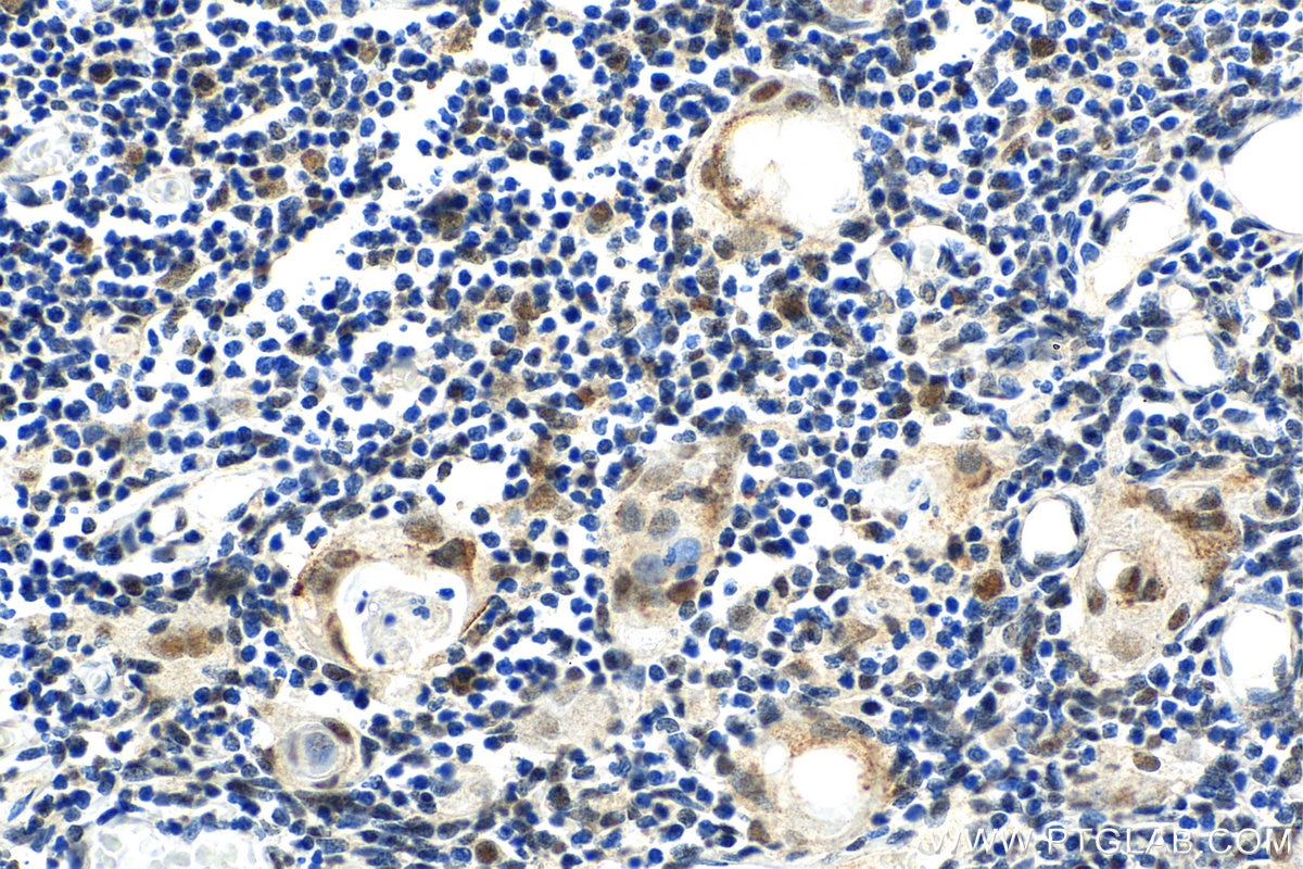 Immunohistochemistry (IHC) staining of human thymus tissue using DLX5 Polyclonal antibody (10592-1-AP)