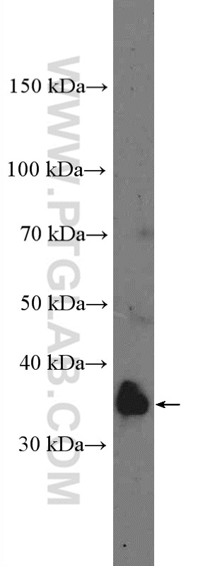 Western Blot (WB) analysis of U-251 cells using DLX5 Polyclonal antibody (10592-1-AP)