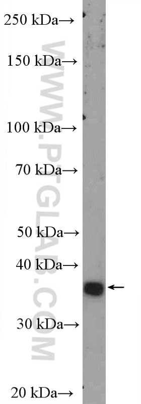 WB analysis of A549 using 10592-1-AP