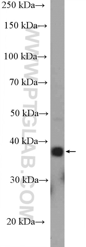 Western Blot (WB) analysis of A375 cells using DLX5 Polyclonal antibody (10592-1-AP)