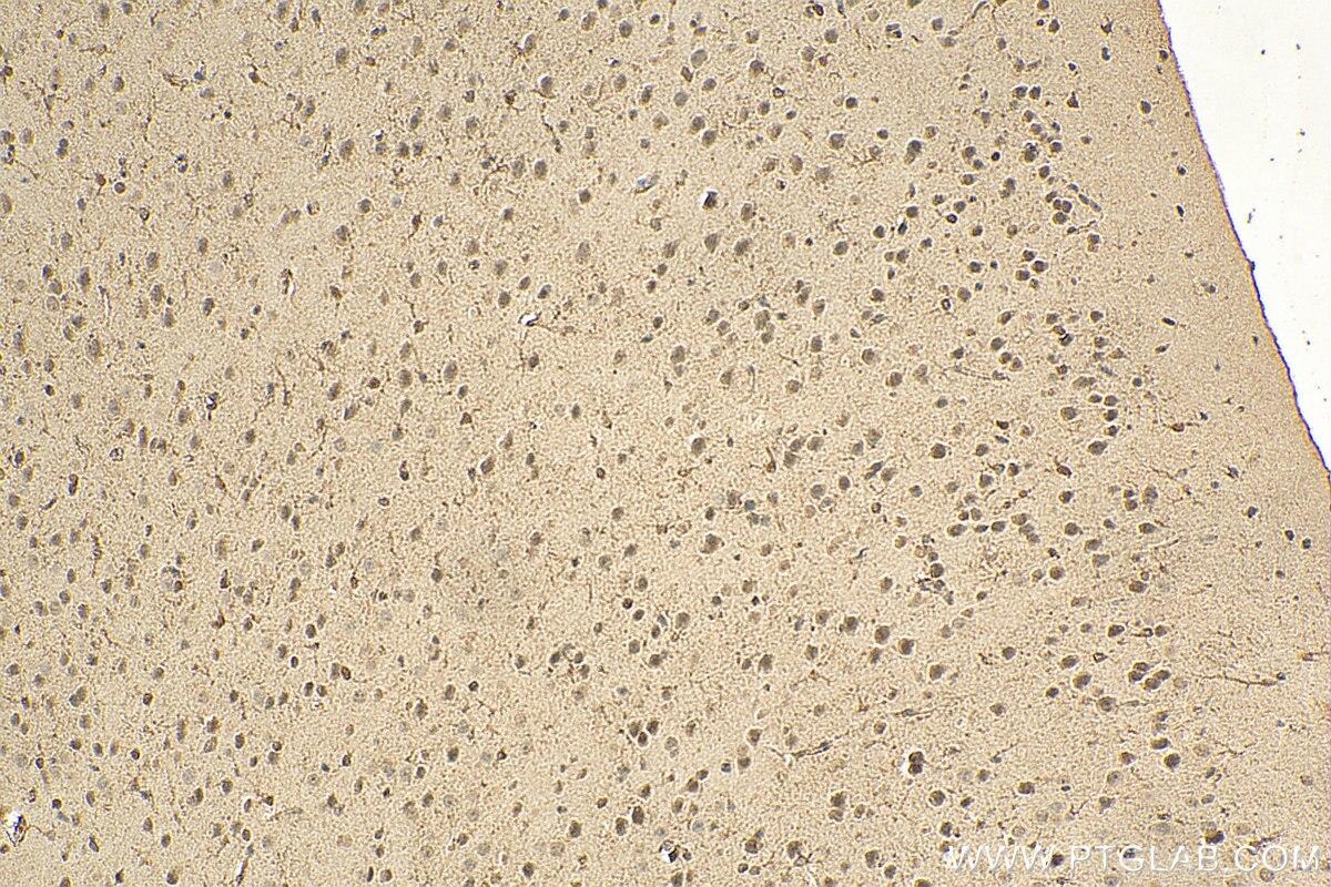 Immunohistochemistry (IHC) staining of mouse brain tissue using DLX5 Monoclonal antibody (67111-1-Ig)