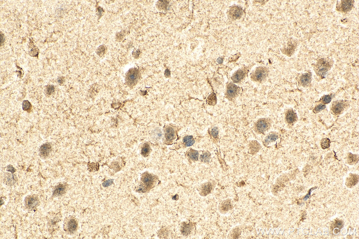 Immunohistochemistry (IHC) staining of mouse brain tissue using DLX5 Monoclonal antibody (67111-1-Ig)