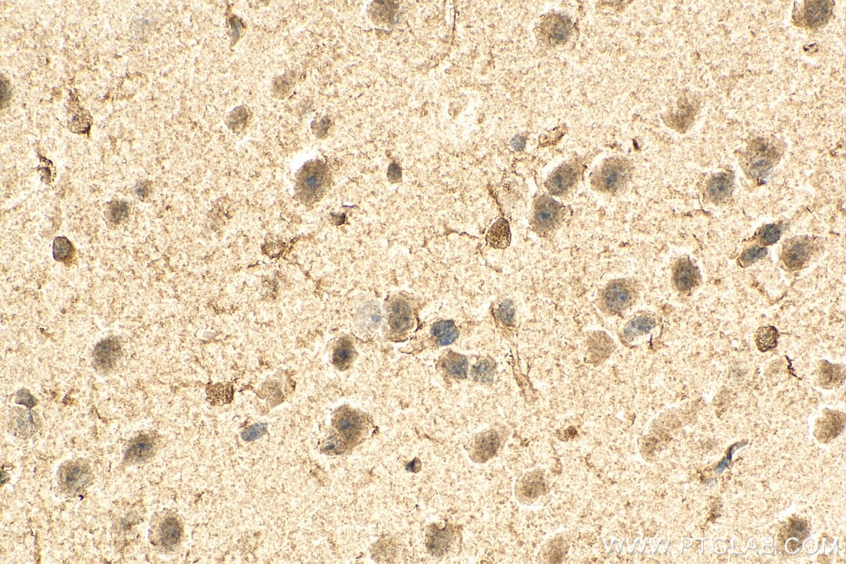 IHC staining of mouse brain using 67111-1-Ig